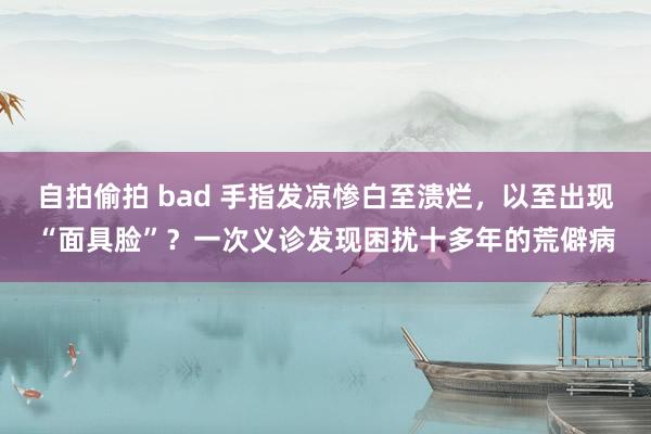 自拍偷拍 bad 手指发凉惨白至溃烂，以至出现“面具脸”？一次义诊发现困扰十多年的荒僻病